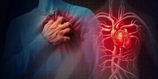 Awas! Bahaya Serangan Jantung, Ternyata Golongan Darah Ini Beresiko Tinggi